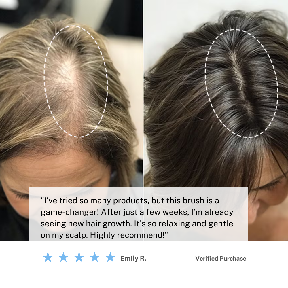 BowLift | Cordless Scalp Massaging Brush – Boost Hair Growth & Relax at Home