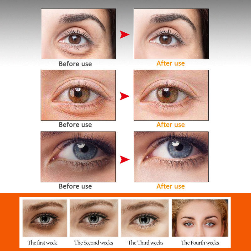 BowLift | Hexapeptide Eye Serum