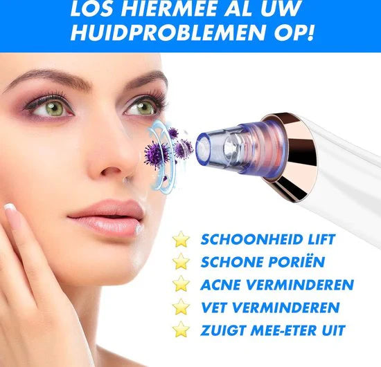 BowLift | Electric Blackhead Remover