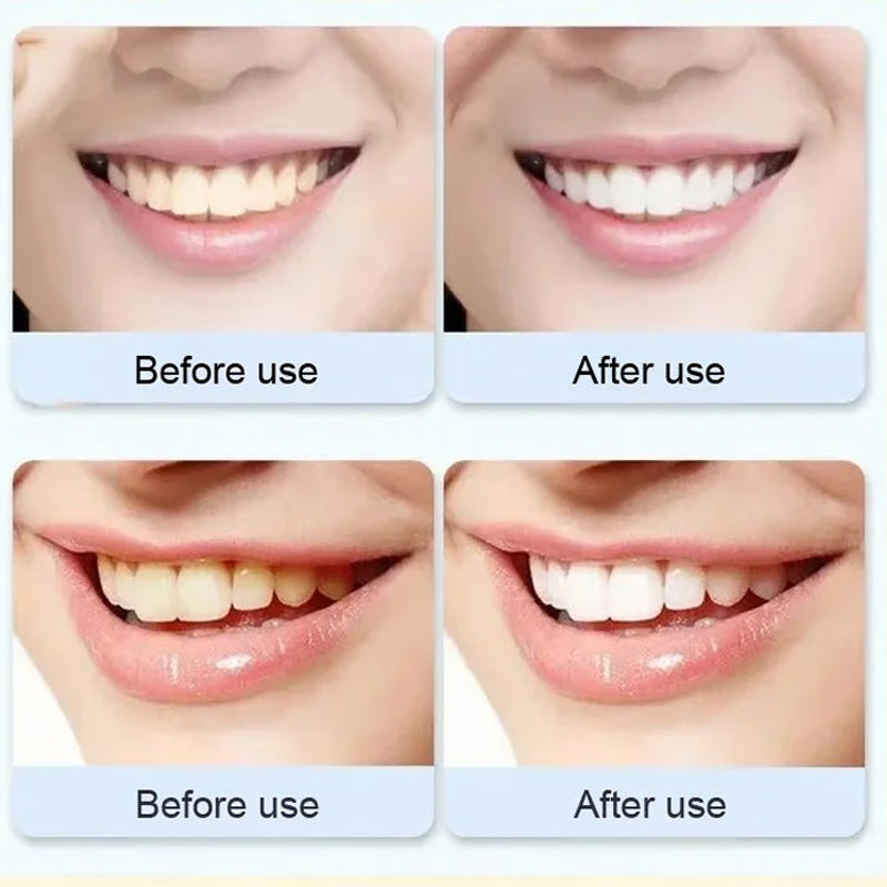 BowLift | Super Probiotic-6 Toothpaste