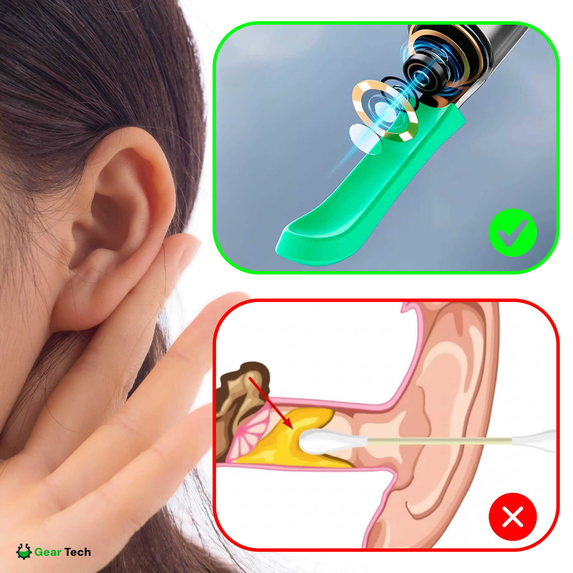 BowLift | EarScope Pro Ear Wax Removal Kit | High-Resolution Camera & LED Lights for Safe Home Use