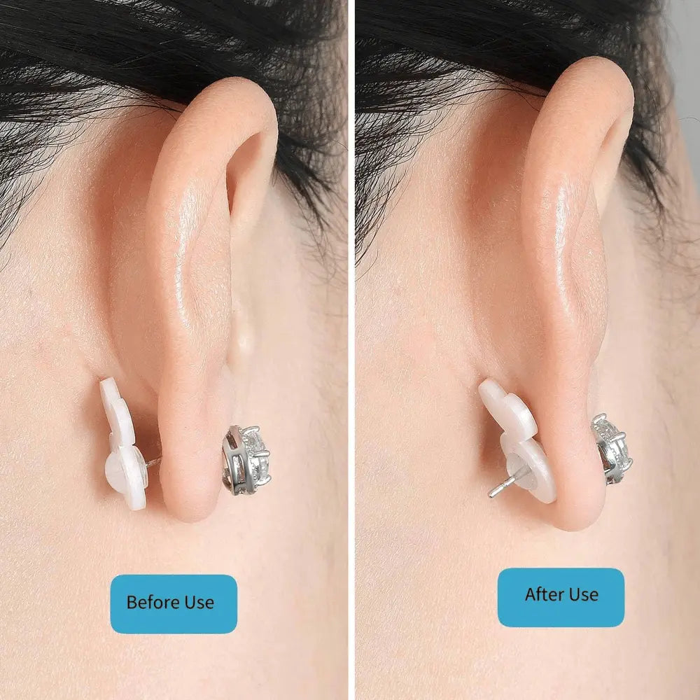 BowLift | Earring Stabilizer – For secure hold of heavy earrings without sagging