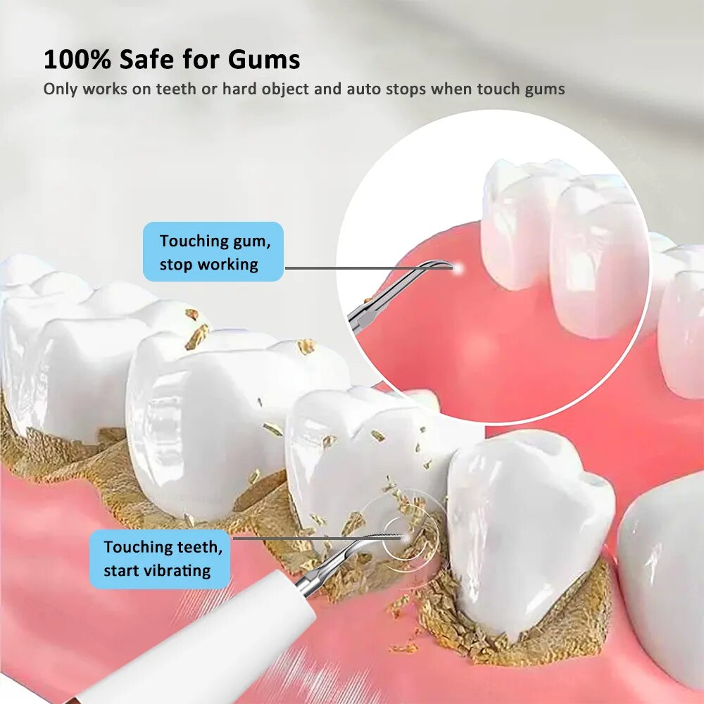 BowLift | Electric Dental Calculus Remover
