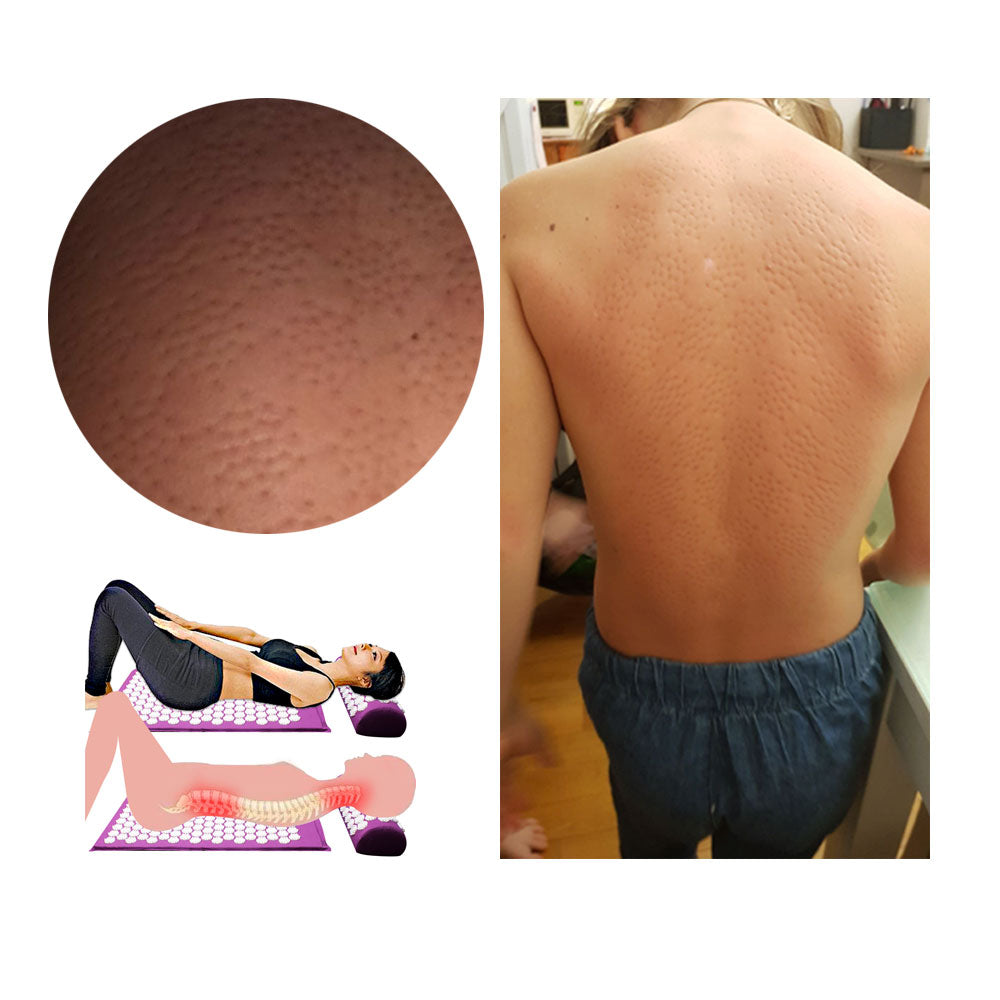 BowLift | Acupressure Yoga Mat & Cushion Set - RelaxMat