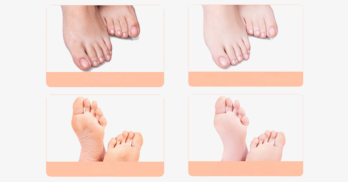 BowLift | Baby Foot Peeling Mask (1 Pack)