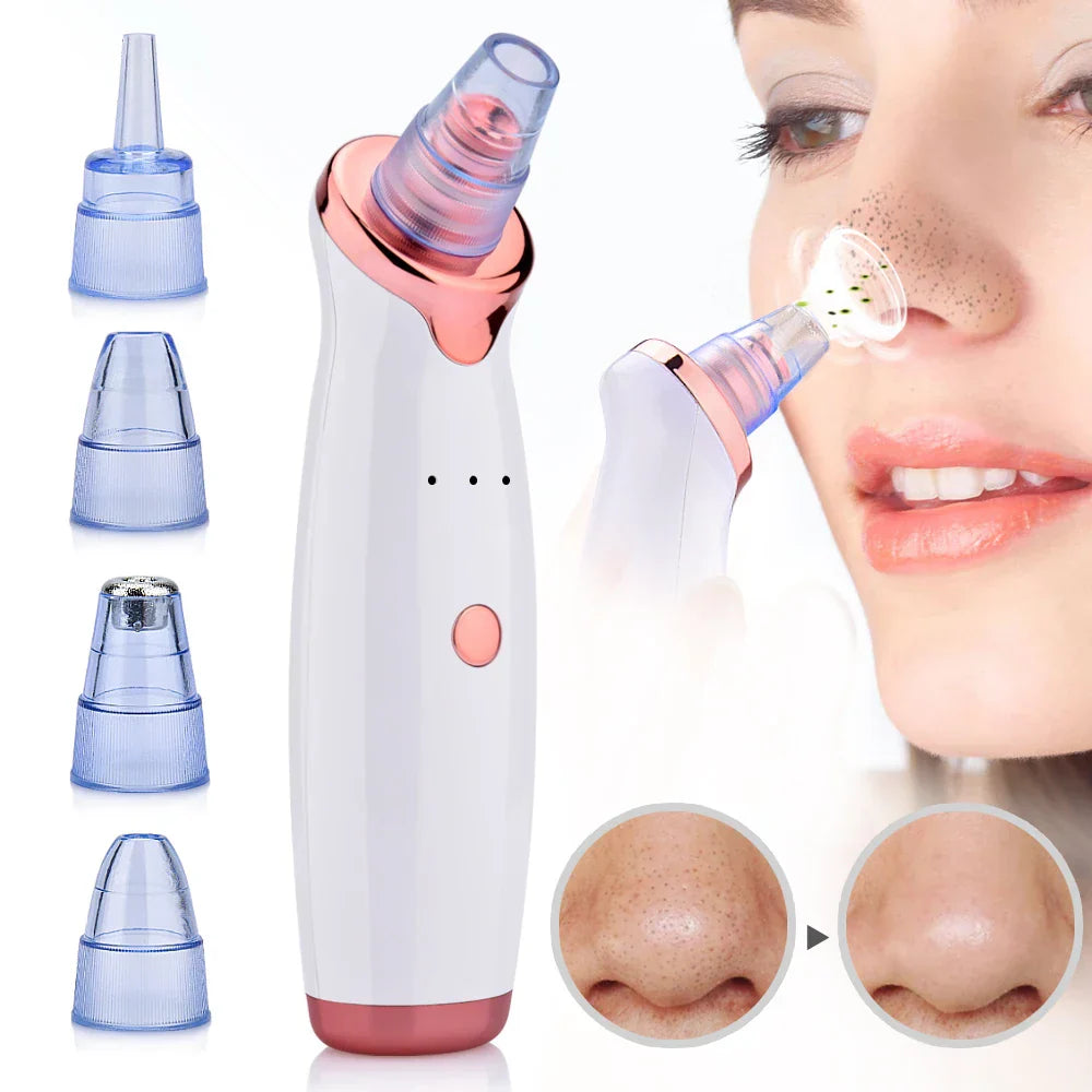 BowLift | Blackhead Remover Vacuum Pore Cleansing Device