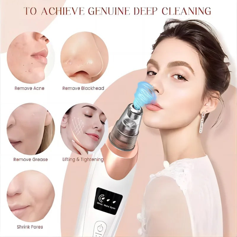 BowLift | Blackhead Remover Vacuum Pore Cleaner | Adjustable Suction, Multi-Functional Tool for Deep Cleansing & Acne Treatment at Home