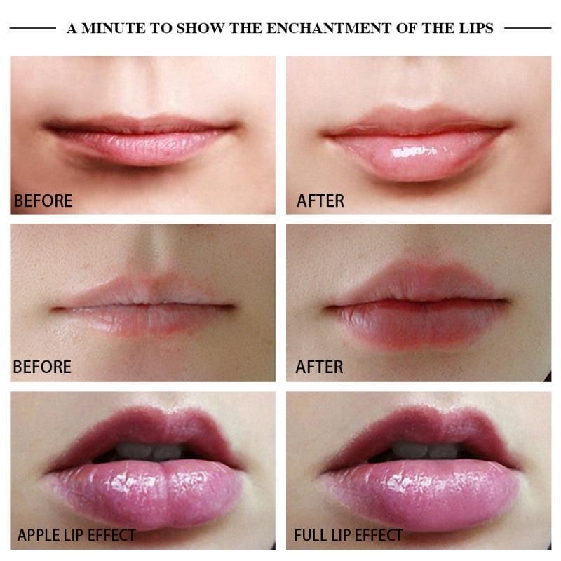 BowLift | Electric Automatic Lip Plumping Device