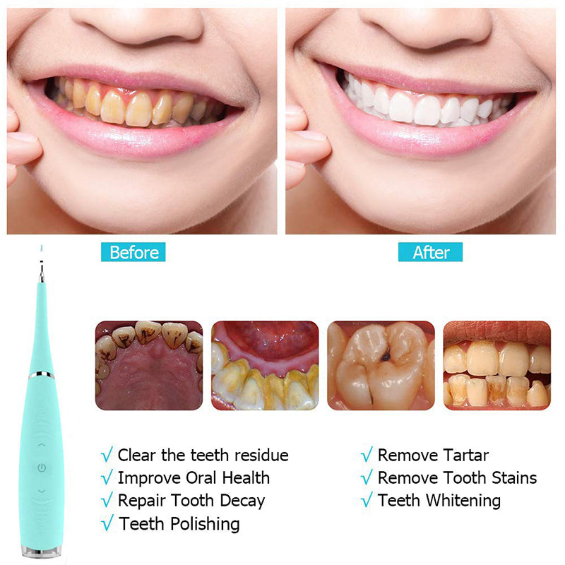 BowLift | Teeth Flosser