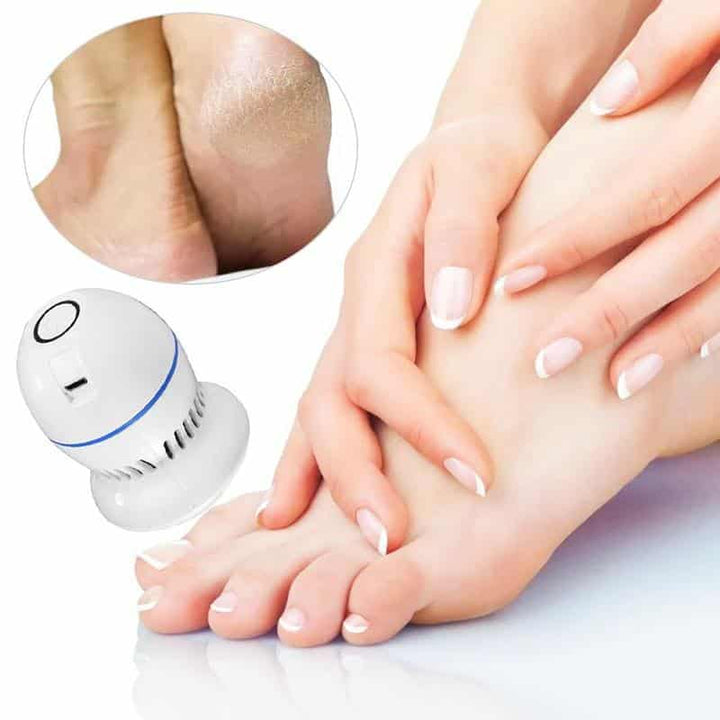 Electric Pedicure Foot File - Rechargeable via USB | Bowlift