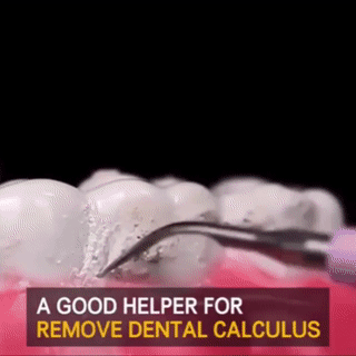 BowLift | Electric Dental Calculus Remover
