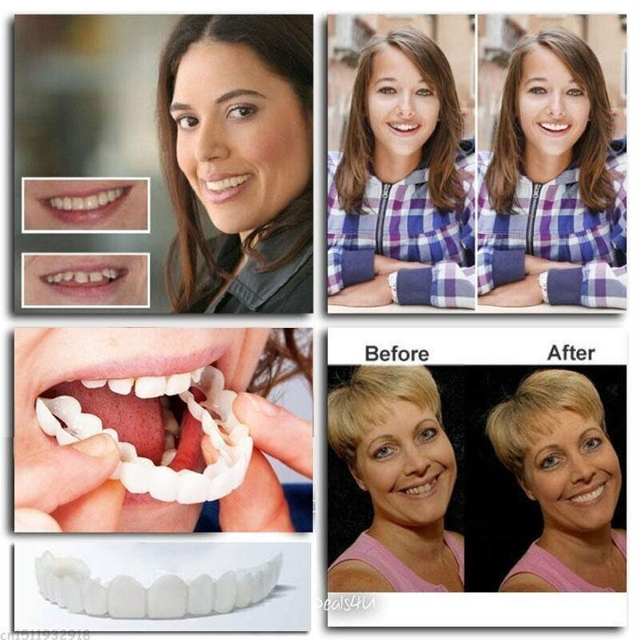 BowLift | Adjustable Snap-On Dentures
