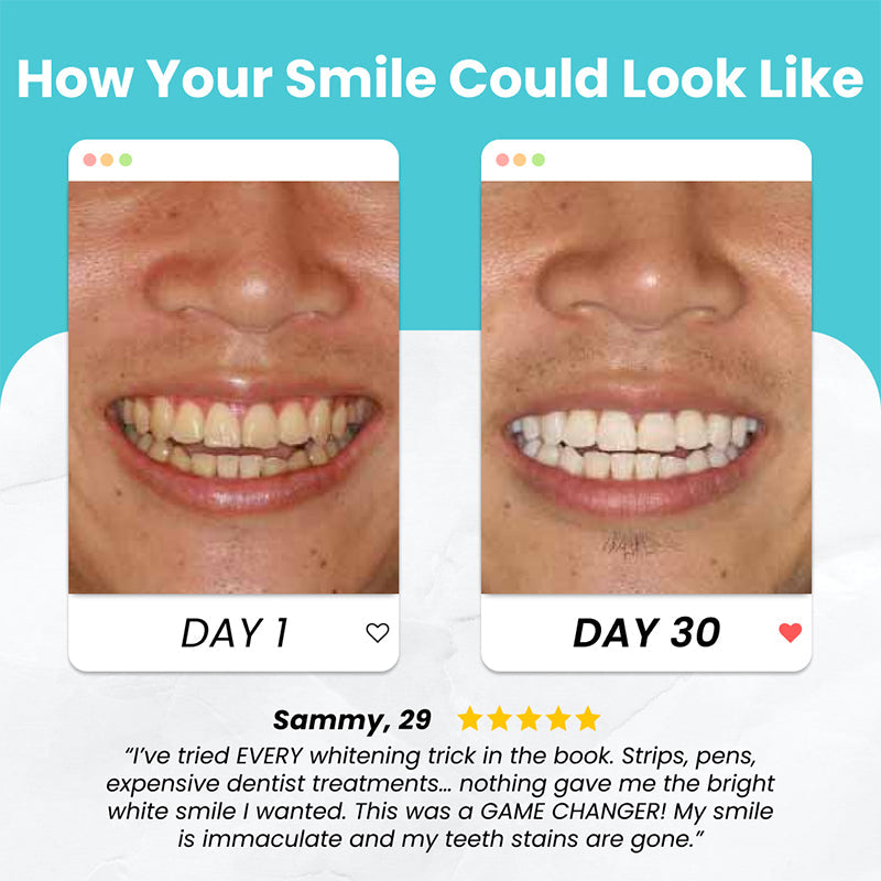 BowLift | U Shaped Electric Toothbrush