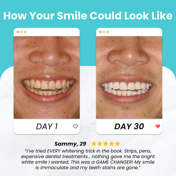 BowLift | U Shaped Electric Toothbrush