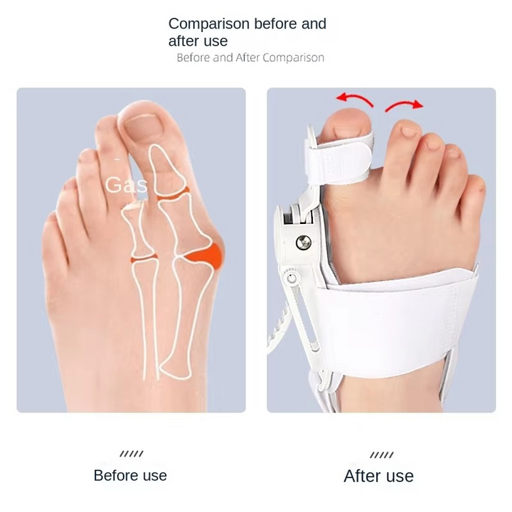 BowLift | FlexiStep — Frees You From Foot Pain For Light-Footed Days Full Of Joy