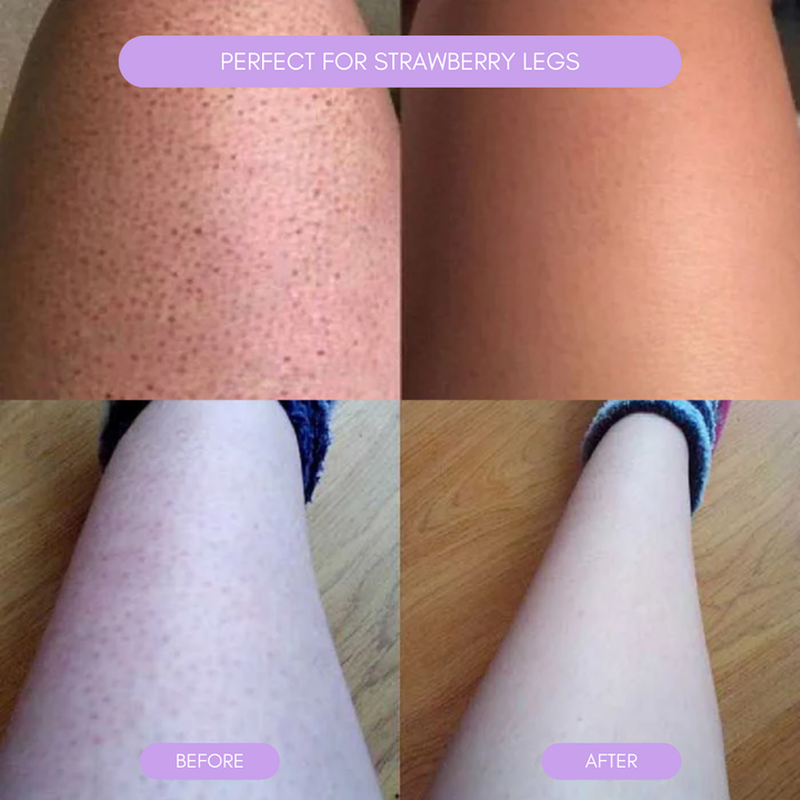 BowLift | Hair removal device for smooth soft skin