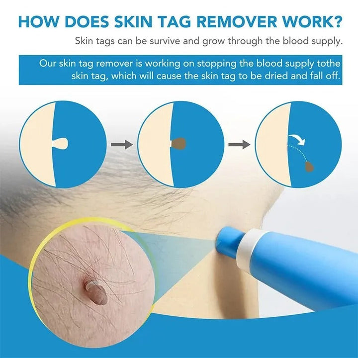 BowLift | Hair Growth Remover Kit