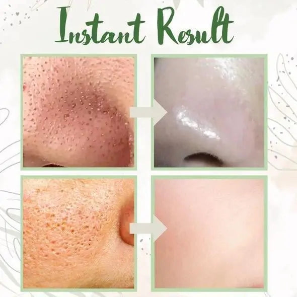 BowLift | Green Tea Deep Cleansing Mask – Against Sebum, Dirt & Clogged Pores