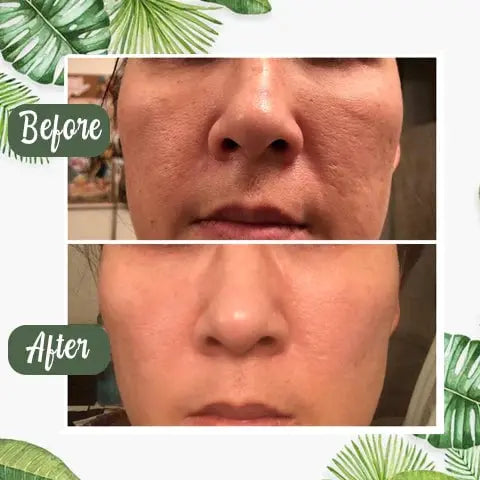 BowLift | Green Tea Deep Cleansing Mask – Against Sebum, Dirt & Clogged Pores