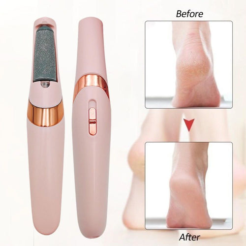 Electric Foot File Hard Skin Remover Bowlift