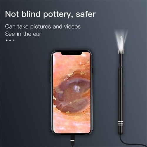 BowLift | Ear cleaning tool with camera
