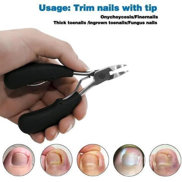 BowLift | Medical nail clipper