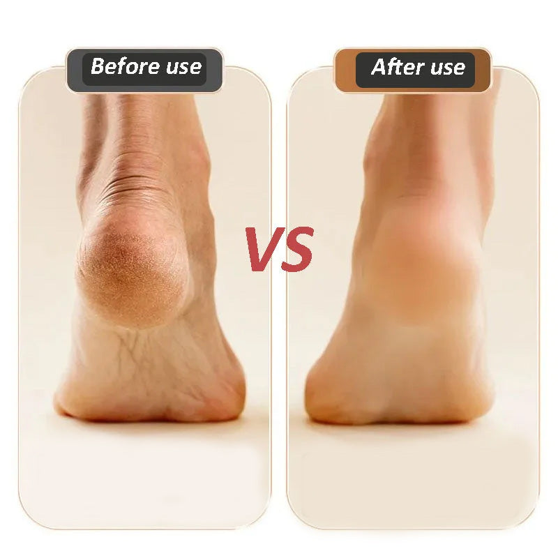 BowLift | Electric Callus Foot Grinder