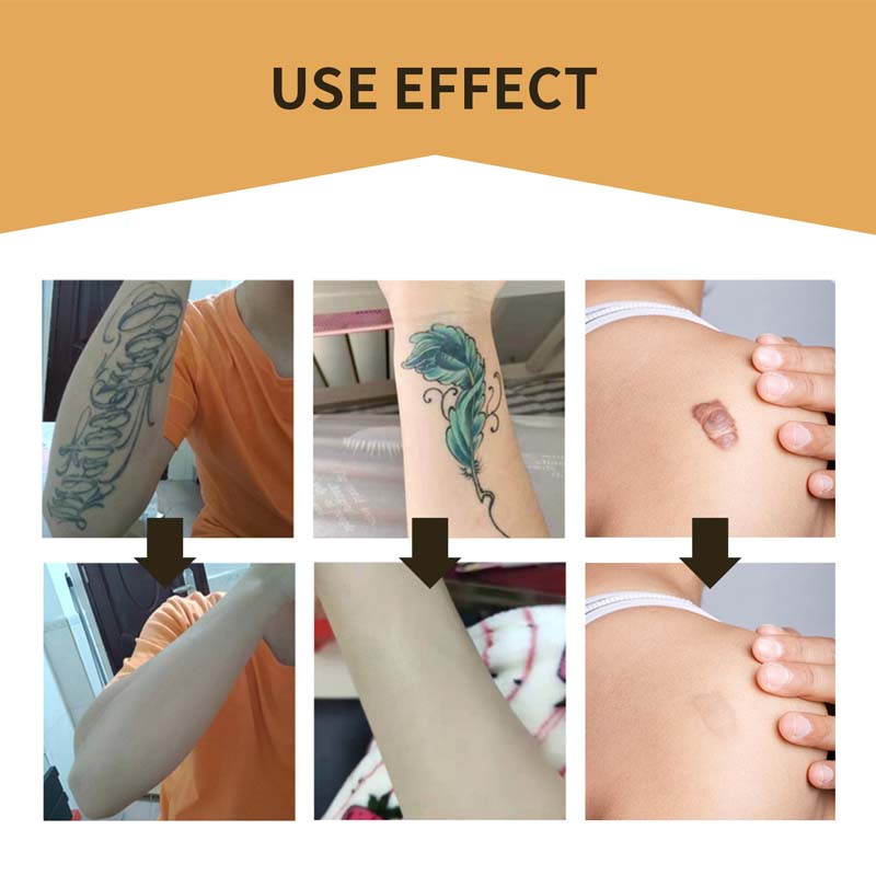 BowLift | Skin Invisible Concealer Patch