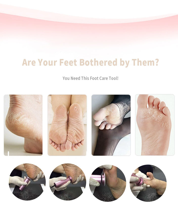BowLift | Callus Remover - Foot Callus Remover