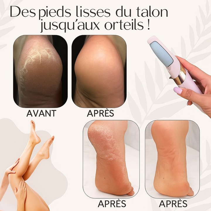 BowLift | PediSoin | Soft and Silky Feet