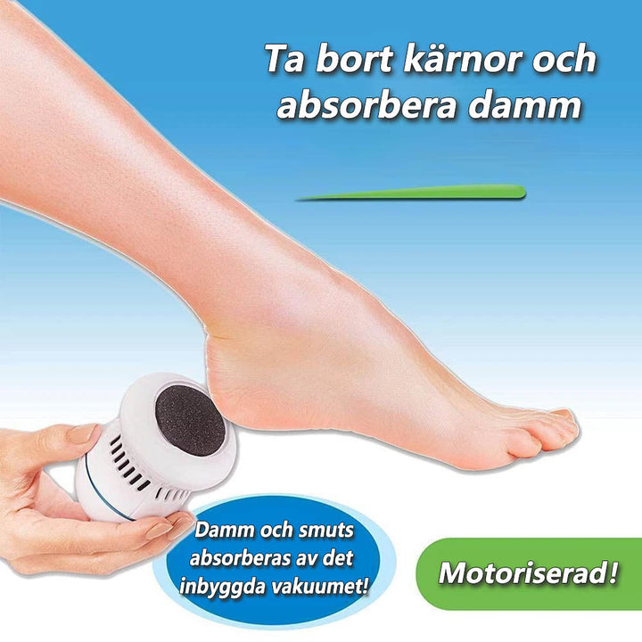 BowLift | SoleSmooth - Callus Remover