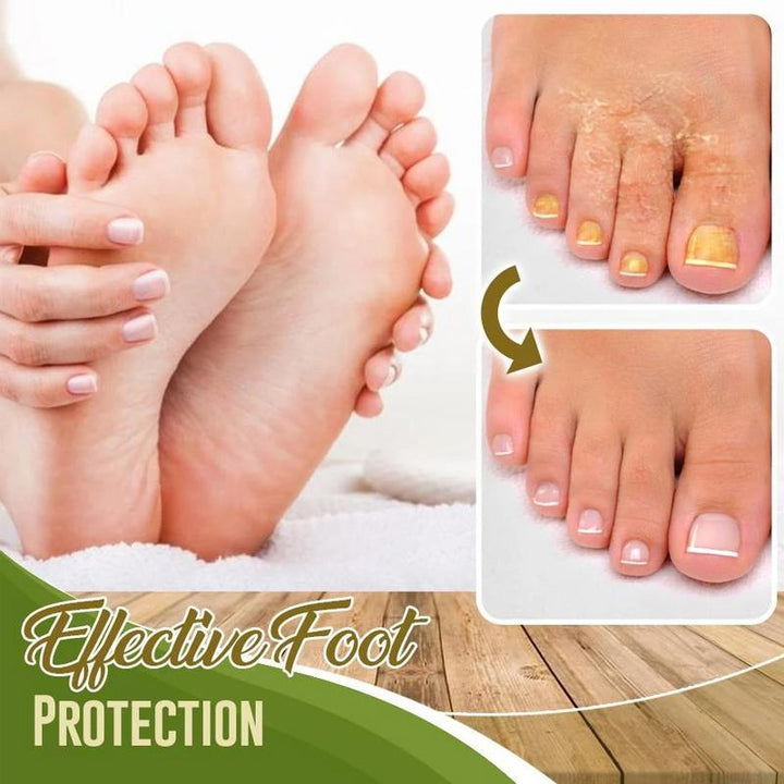 BowLift | Foot deodorant and moisture absorber spray