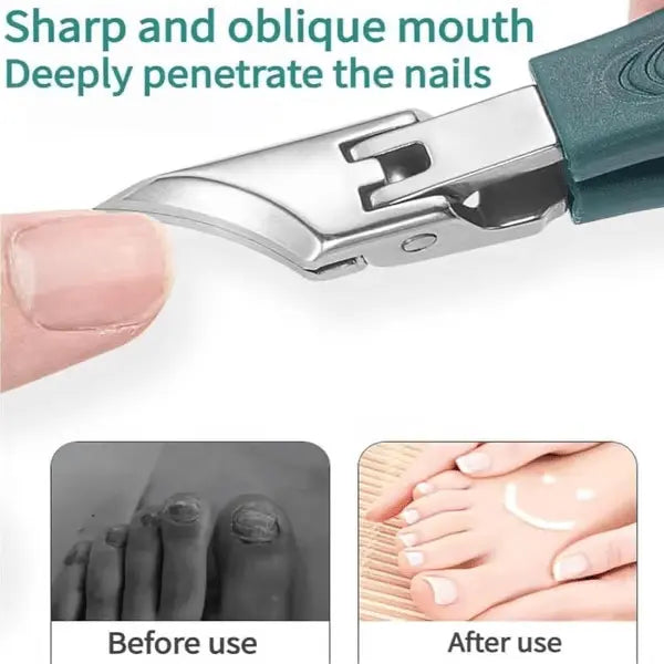 BowLift | 3-piece nail care set for ingrown nails
