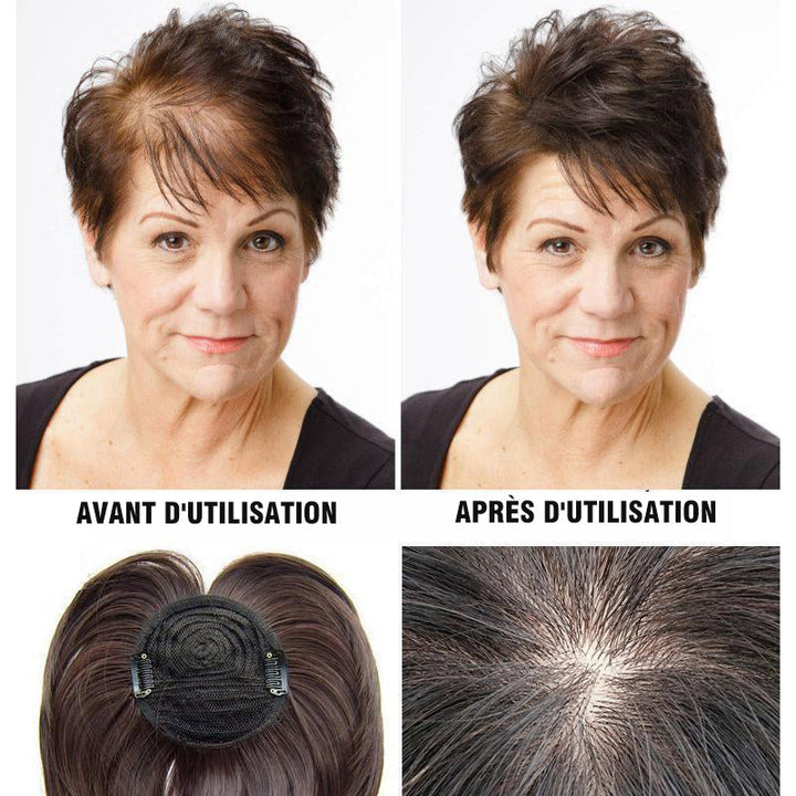 Replacement patch for wig | Bowlift