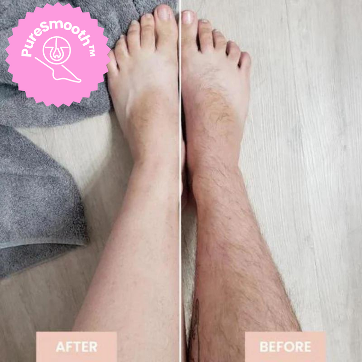 BowLift | LuxeLaser Flawless Hair Removal in 60 Seconds