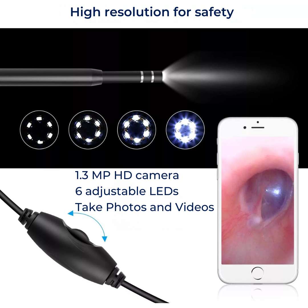 EarVision Professional Ear Endoscope – HD Inspection – Live Monitoring – Capture Images & Video – Removes Wax & Foreign Objects Bowlift