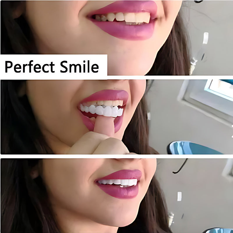 BowLift | Simulation whitening dentures