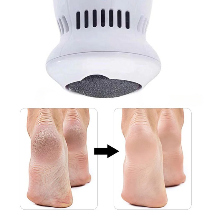 BowLift | Perfect foot care without effort