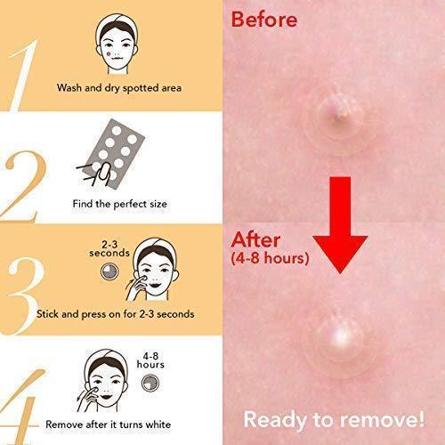 BowLift | Skin Tag and Acne Patch