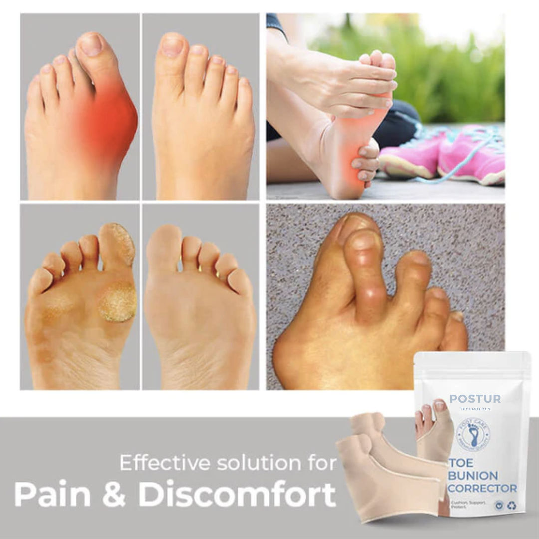 BowLift | Hallux Valgus Corrector 2.0 – corrective support – pain relief – comfortable – wall clock