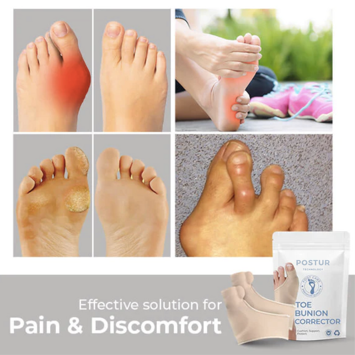 BowLift | Hallux Valgus Corrector 2.0 – corrective support – pain relief – comfortable – wall clock