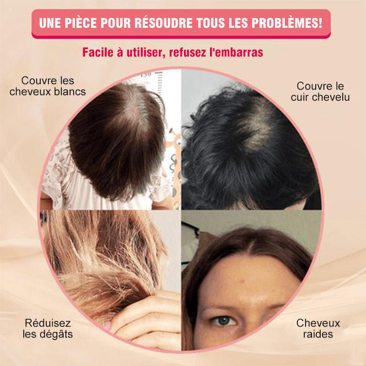 Replacement patch for wig | Bowlift