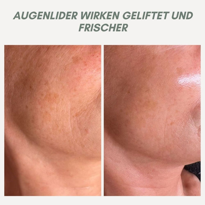 BowLift | YouthMorph — Tight skin in minutes for your youthful WOW moment