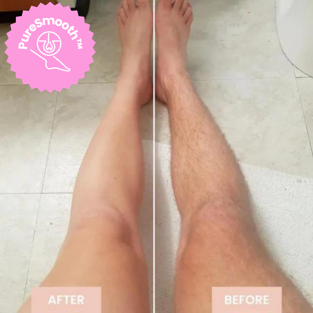 BowLift | LuxeLaser Flawless Hair Removal in 60 Seconds