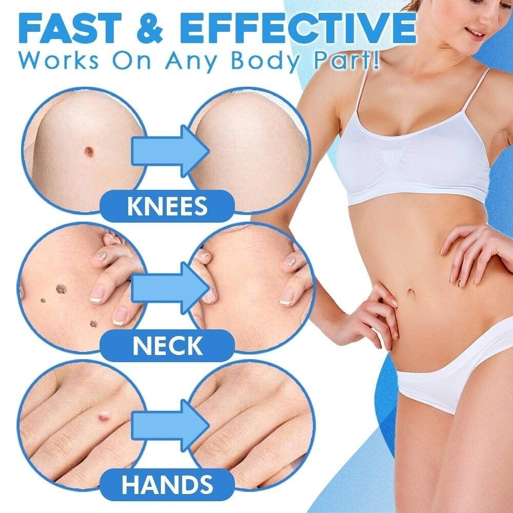 BowLift | SmoothZap — Pain-free skin freedom for a new sense of confidence in just 10 days