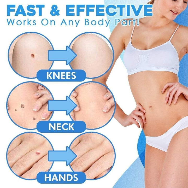 BowLift | SmoothZap — Pain-free skin freedom for a new sense of confidence in just 10 days