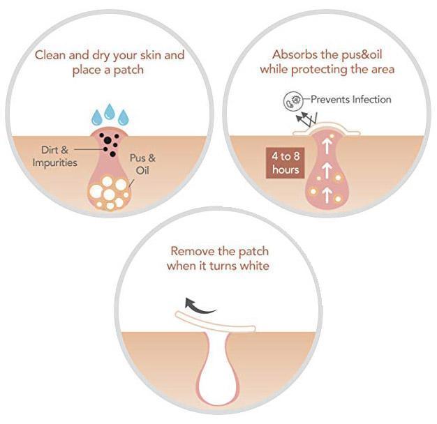 BowLift | Skin Tag and Acne Patch
