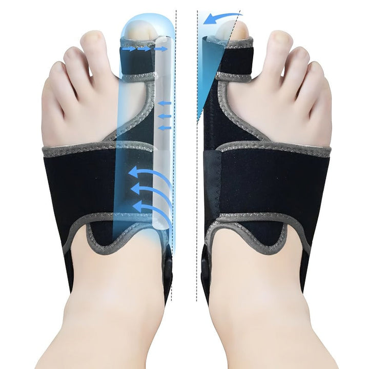 BowLift | Adjustable hallux valgus corrector