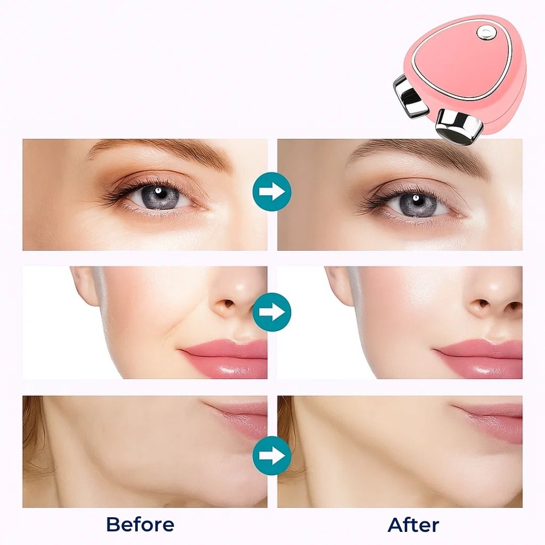RejuvTone | EMS Facial Toner – Non‑surgical Lift – USB‑rechargeable Lightweight Device – Anti‑ageing Skincare Bowlift