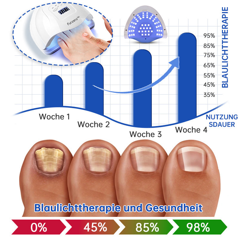BowLift | PureNail™ | Nail Fungus Laser Therapy Device - Your Secret Weapon Against Nail Fungus